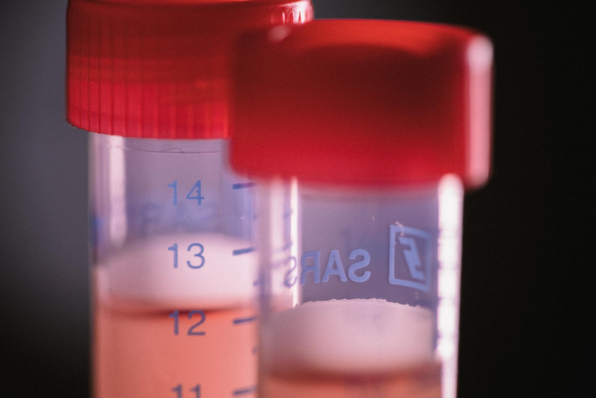 Blood samples collected by Dr. Kasarskis and his team.