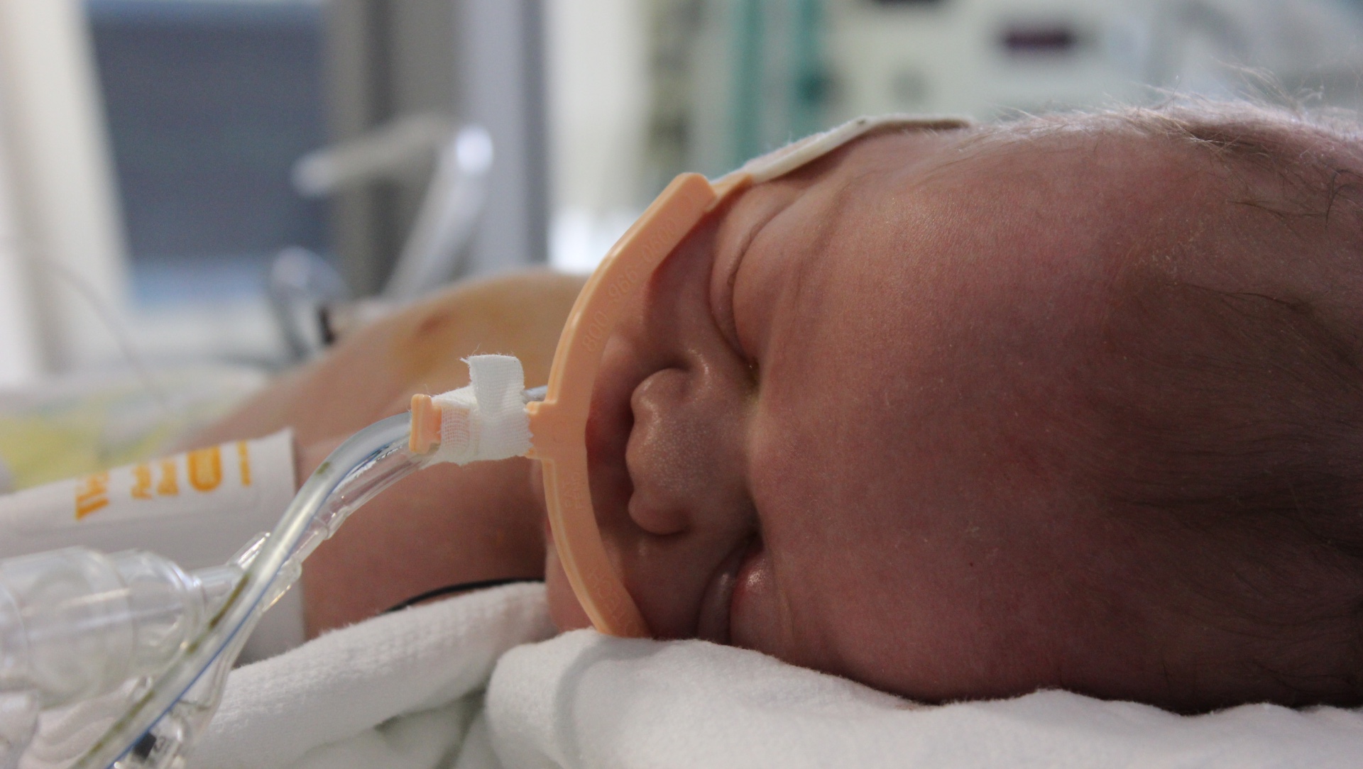 Baby Henry lays on a hospital bed with a breathing cannula attached to him and multiple medical equipment behind him.