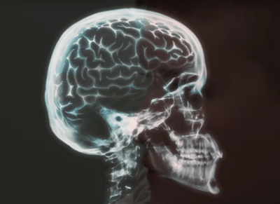 Joey Maggard's brain mapping image