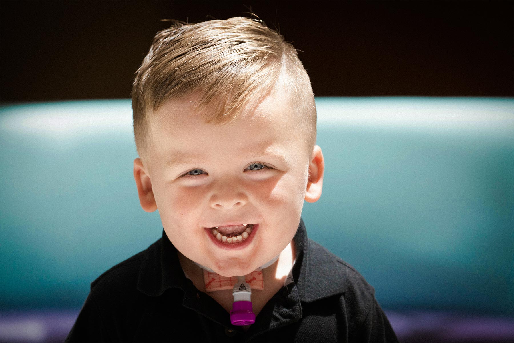 Kase smiles big for the camera. His tracheostomy tube is visible, which helps him breathe.