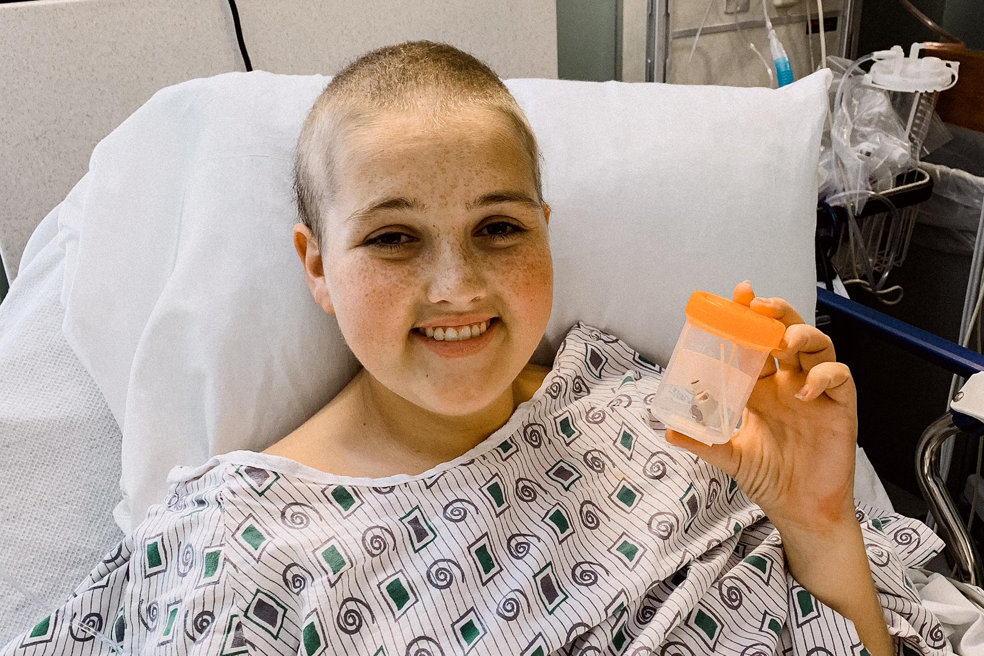 Kylee Tyson, having lost her hair during chemotherapy, smiles while receiving treatment