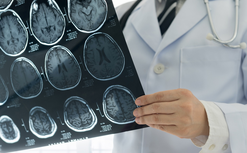 A doctor holds a brain scan