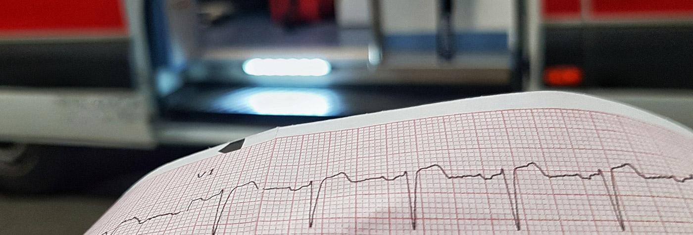 Image of EKG readout.